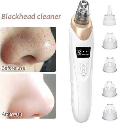 Multifunction Blackhead Remover – 5-in-1 Deep Pore Cleansing