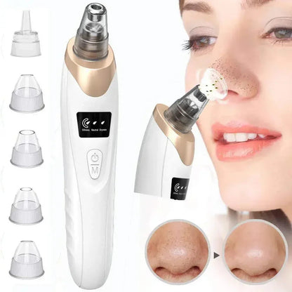 Multifunction Blackhead Remover – 5-in-1 Deep Pore Cleansing