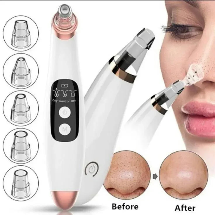 Multifunction Blackhead Remover – 5-in-1 Deep Pore Cleansing